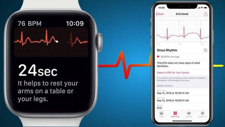 Apple Watch EKG Uygulaması Nasıl Kullanılır?